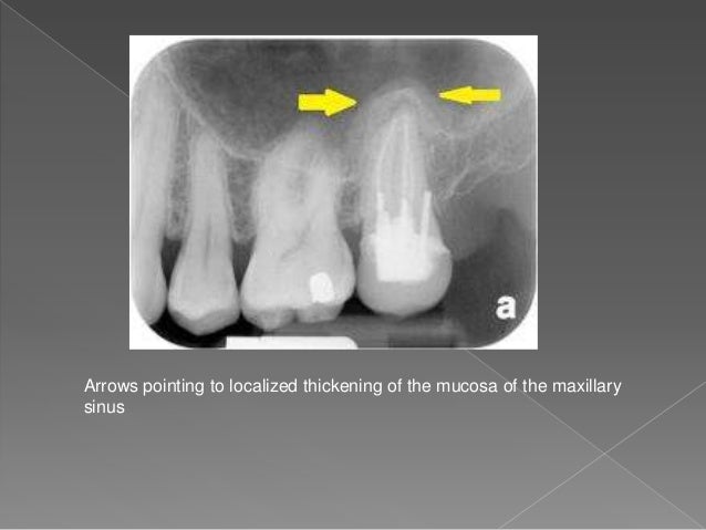 Sildenafil preiswert