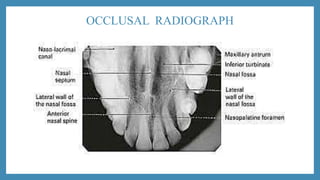 OCCLUSAL RADIOGRAPH
 