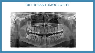 ORTHOPANTOMOGRAPHY
 