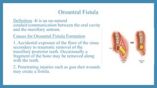 Oroantral Fistula
Definition -It is an un-natural
conduit/communication between the oral cavity
and the maxillary antrum.
Causes for Oroantral Fistula Formation
1. Accidental exposure of the floor of the sinus
secondary to traumatic removal of the
maxillary posterior teeth. Occasionally a
fragment of the bone may be removed along
with the teeth.
2. Penetrating injuries such as gun shot wounds
may create a fistula.
 