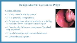 Benign Mucosal Cyst/Antral Polyp
Clinical Findings
• 1. It may occur in any age group
• 2. It is generally asymptomatic
• 3. Patient may have a frontal headache or a feeling
of heaviness in the frontal and orbital region
• 4. Occasionally fullness or numbness of the cheek
may be present
• 5. Nasal obstruction and post nasal discharge
• 6. Deviated nasal septum.
 