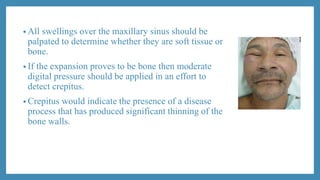 • All swellings over the maxillary sinus should be
palpated to determine whether they are soft tissue or
bone.
• If the expansion proves to be bone then moderate
digital pressure should be applied in an effort to
detect crepitus.
• Crepitus would indicate the presence of a disease
process that has produced significant thinning of the
bone walls.
 
