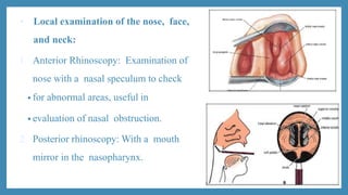 • Local examination of the nose, face,
and neck:
1. Anterior Rhinoscopy: Examination of
nose with a nasal speculum to check
• for abnormal areas, useful in
• evaluation of nasal obstruction.
2. Posterior rhinoscopy: With a mouth
mirror in the nasopharynx.
 