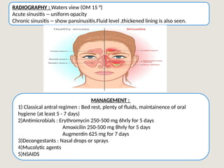 Walters View Maxillary sinus powerpoint presentation in detail | PPTX