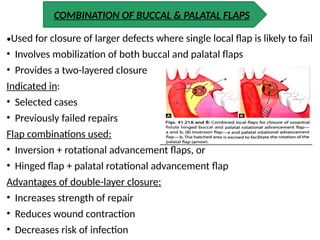 Single Rotation Flap Maxillary sinus powerpoint presentation in detail | PPTX