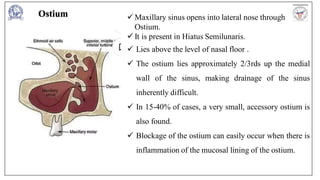 Comprehensive Overview of Maxillary Sinus Anatomy, Development, and ...