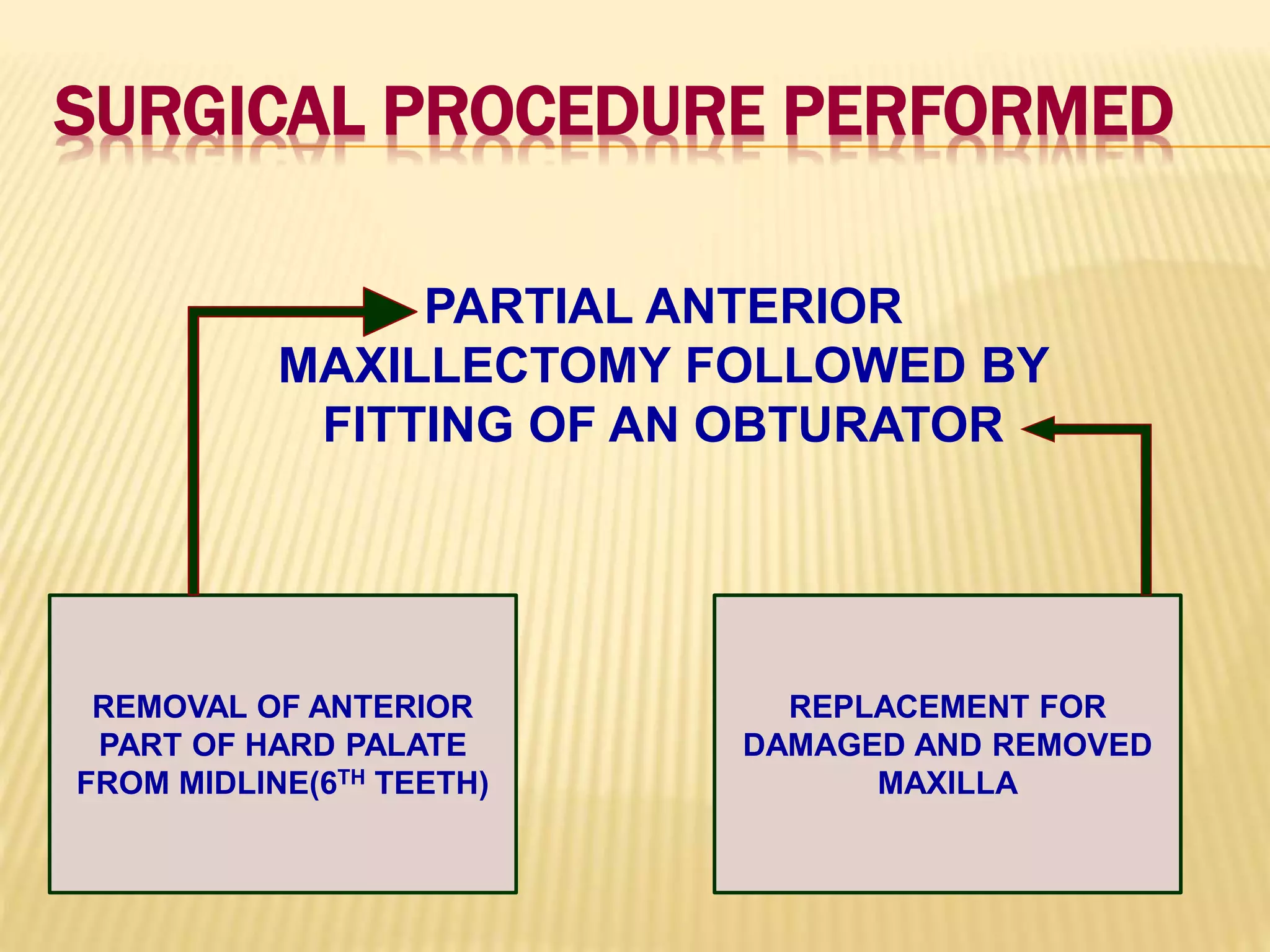SURGICAL PROCEDURE PERFORMED
PARTIAL ANTERIOR
MAXILLECTOMY FOLLOWED BY
FITTING OF AN OBTURATOR
REMOVAL OF ANTERIOR
PART OF HARD PALATE
FROM MIDLINE(6TH TEETH)
REPLACEMENT FOR
DAMAGED AND REMOVED
MAXILLA
 