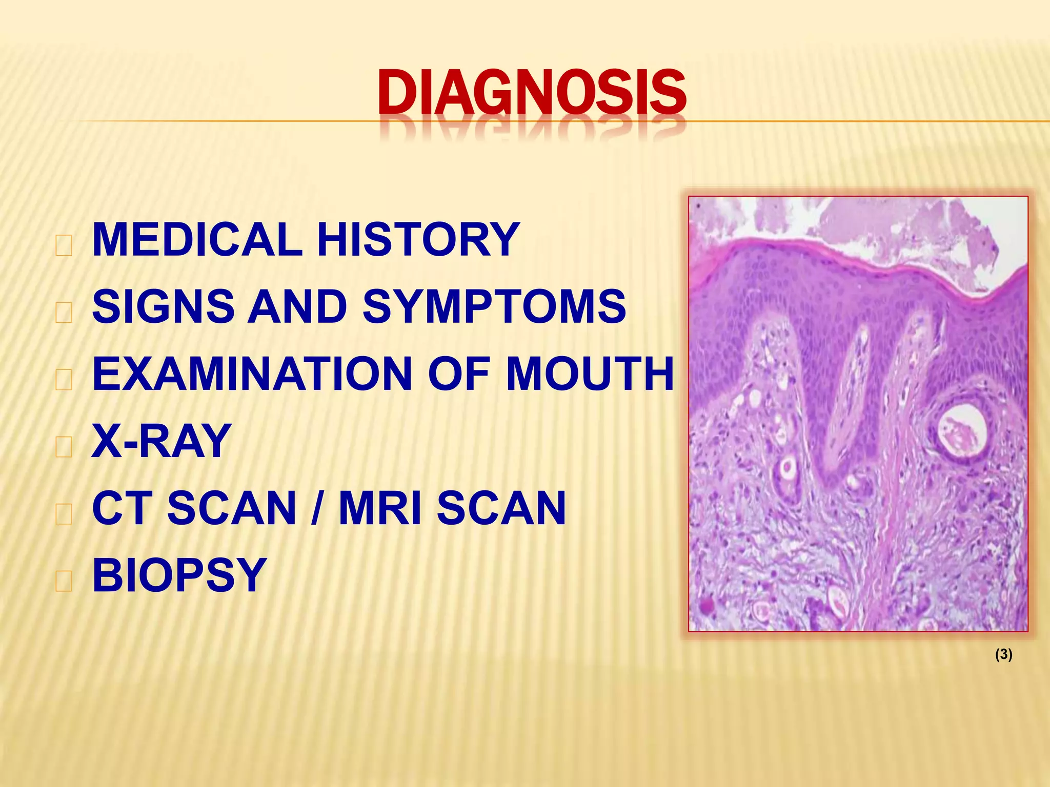 DIAGNOSIS
MEDICAL HISTORY
SIGNS AND SYMPTOMS
EXAMINATION OF MOUTH
X-RAY
CT SCAN / MRI SCAN
BIOPSY
(3)
 