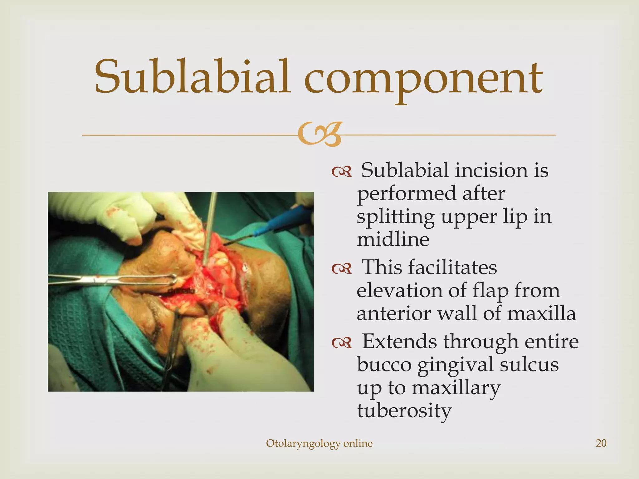 Sublabial component
         
                    Sublabial incision is
                    performed after
                    splitting upper lip in
                    midline
                    This facilitates
                    elevation of flap from
                    anterior wall of maxilla
                    Extends through entire
                    bucco gingival sulcus
                    up to maxillary
                    tuberosity
       Otolaryngology online                   20
 