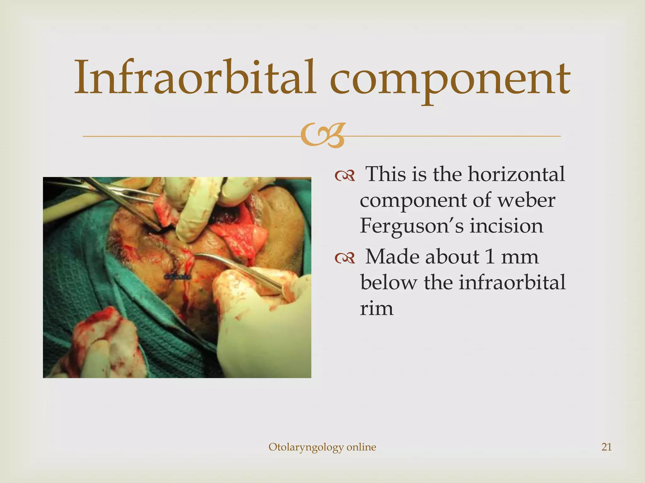 Infraorbital component
           
                     This is the horizontal
                     component of weber
                     Ferguson’s incision
                     Made about 1 mm
                     below the infraorbital
                     rim




        Otolaryngology online                  21
 