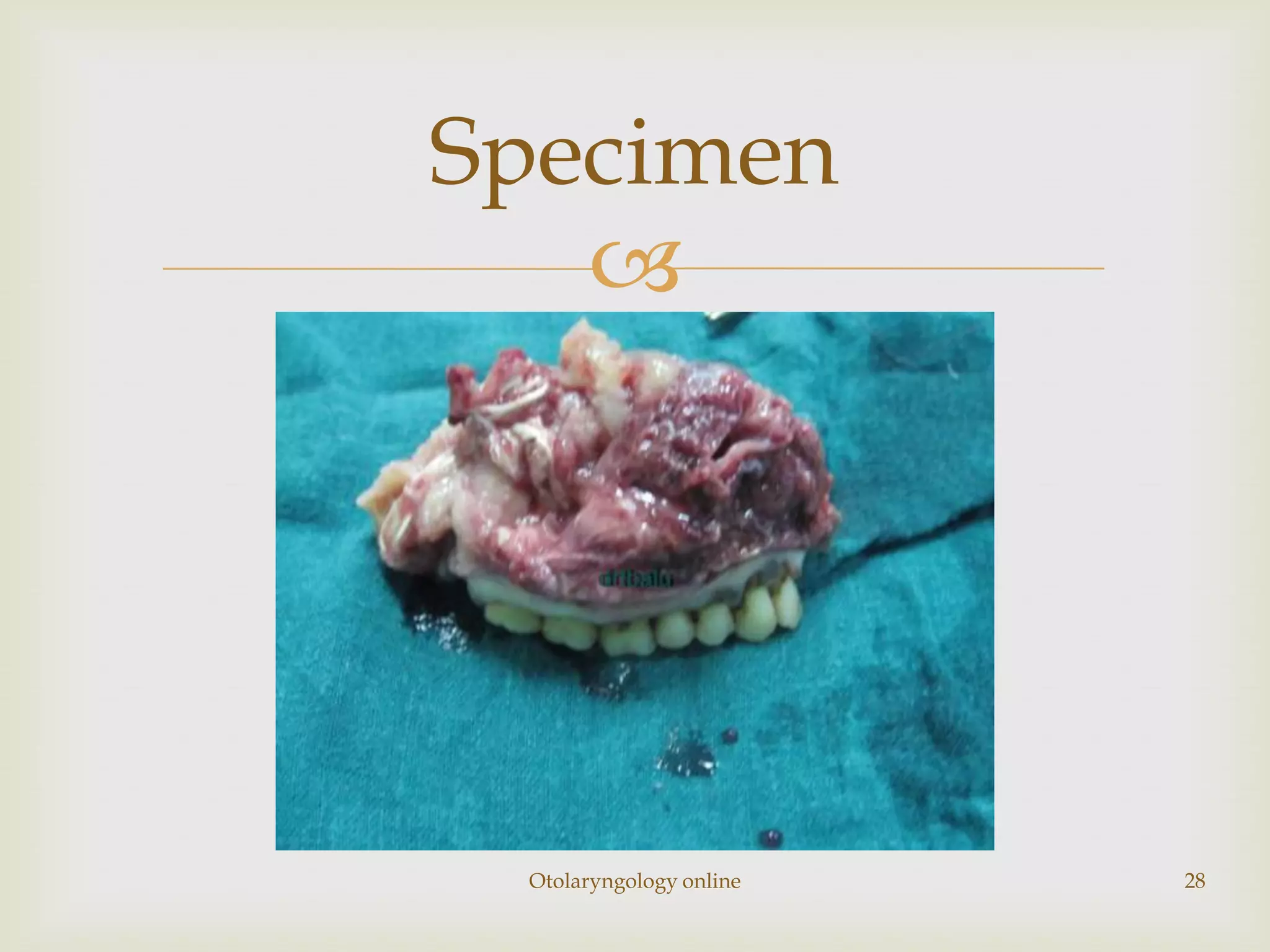 Specimen
   




 Otolaryngology online   28
 