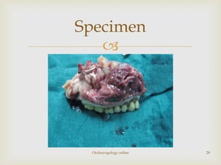 Specimen
   




 Otolaryngology online   28
 