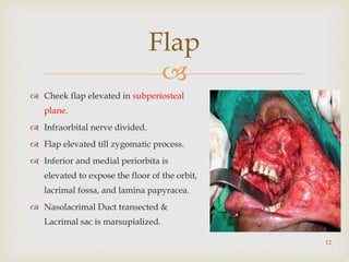 
Flap
12
 Cheek flap elevated in subperiosteal
plane.
 Infraorbital nerve divided.
 Flap elevated till zygomatic process.
 Inferior and medial periorbita is
elevated to expose the floor of the orbit,
lacrimal fossa, and lamina papyracea.
 Nasolacrimal Duct transected &
Lacrimal sac is marsupialized.
 