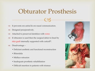 
Obturator Prosthesis
17
 It prevents oro-antral & oro-nasal communication.
 Designed preoperatively.
 Attached to preserved dentition with wires
 If obturator is used then the surgical defect is lined by
skin graft internally supported with cuticell@.
 Disadvantage –
• Deficient aesthetic and functional reconstruction
• Rhinolalia
• Midface retrusion
• Inadequate prosthetic rehabilitation
• Difficult insertion in patients with trismus
 