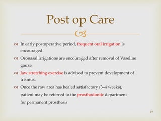 
 In early postoperative period, frequent oral irrigation is
encouraged.
 Oronasal irrigations are encouraged after removal of Vaseline
gauze.
 Jaw stretching exercise is advised to prevent development of
trismus.
 Once the raw area has healed satisfactory (3–4 weeks),
patient may be referred to the prosthodontic department
for permanent prosthesis
19
Post op Care
 