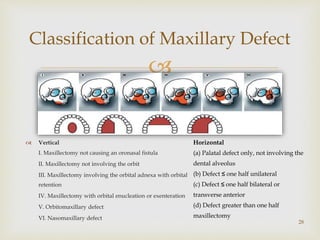 
Classification of Maxillary Defect
28
 Vertical
I. Maxillectomy not causing an oronasal fistula
II. Maxillectomy not involving the orbit
III. Maxillectomy involving the orbital adnexa with orbital
retention
IV. Maxillectomy with orbital enucleation or exenteration
V. Orbitomaxillary defect
VI. Nasomaxillary defect
Horizontal
(a) Palatal defect only, not involving the
dental alveolus
(b) Defect ≤ one half unilateral
(c) Defect ≤ one half bilateral or
transverse anterior
(d) Defect greater than one half
maxillectomy
 