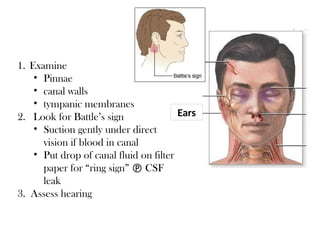 Ears
1. Examine
• Pinnae
• canal walls
• tympanic membranes
2. Look for Battle’s sign
• Suction gently under direct
vision if blood in canal
• Put drop of canal fluid on filter
paper for “ring sign”  CSF
leak
3. Assess hearing
 