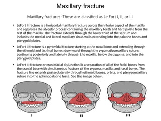 Maxillary fracture
Maxillary fractures: These are classified as Le Fort I, II, or III
• LeFort I fracture is a horizontal maxillary fracture across the inferior aspect of the maxilla
and separates the alveolar process containing the maxillary teeth and hard palate from the
rest of the maxilla. The fracture extends through the lower third of the septum and
includes the medial and lateral maxillary sinus walls extending into the palatine bones and
pterygoid plates.
• LeFort II fracture is a pyramidal fracture starting at the nasal bone and extending through
the ethmoid and lacrimal bones; downward through the zygomaticomaxillary suture;
continuing posteriorly and laterally through the maxilla, below the zygoma; and into the
pterygoid plates.
• LeFort III fracture or craniofacial disjunction is a separation of all of the facial bones from
the cranial base with simultaneous fracture of the zygoma, maxilla, and nasal bones. The
fracture line extends posterolaterally through ethmoid bones, orbits, and pterygomaxillary
suture into the sphenopalatine fossa. See the image below :
 