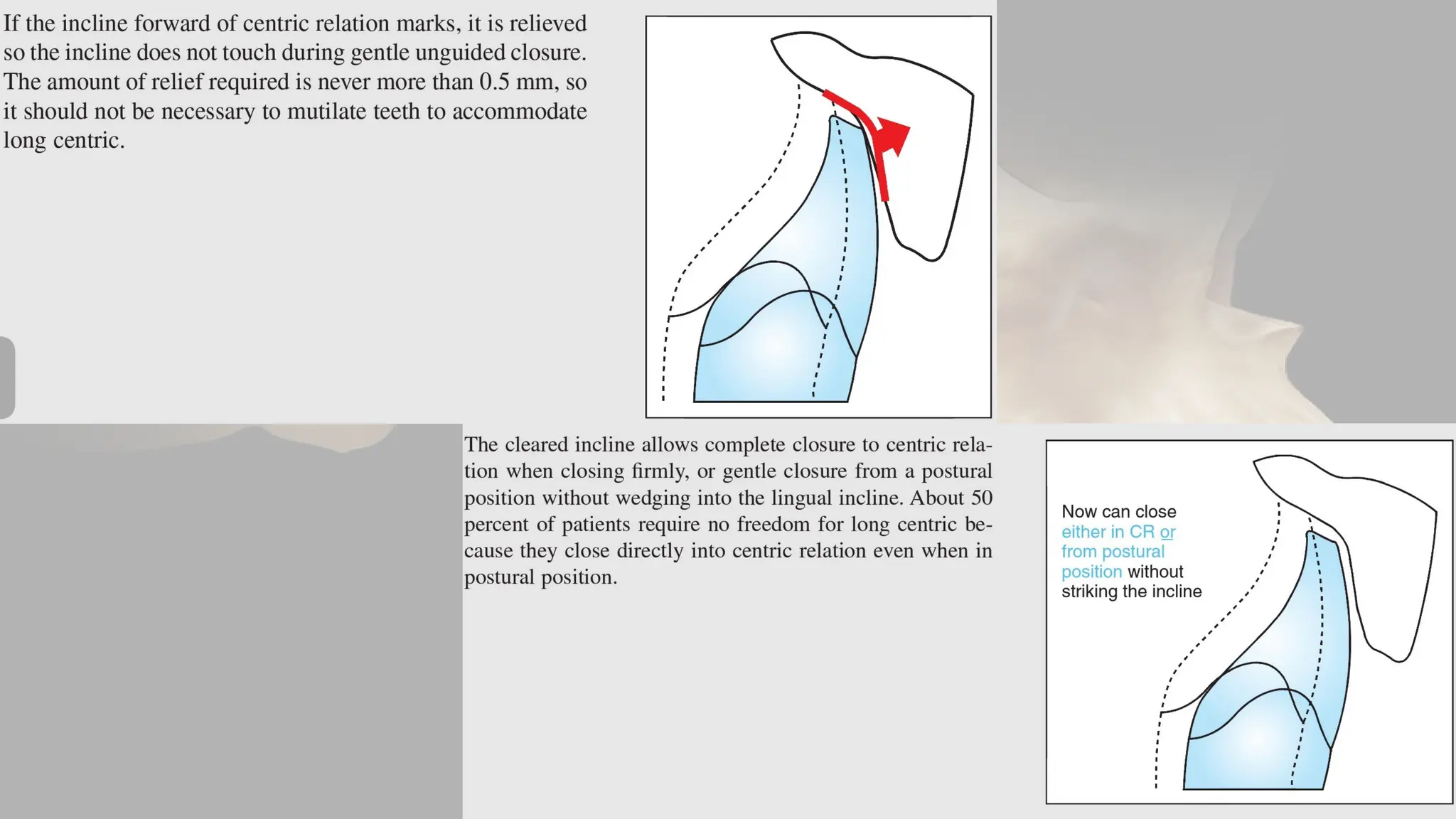 MAXILLO-MANDIBULAR RELATIONS IN PROSTHODONTICS | PPTX