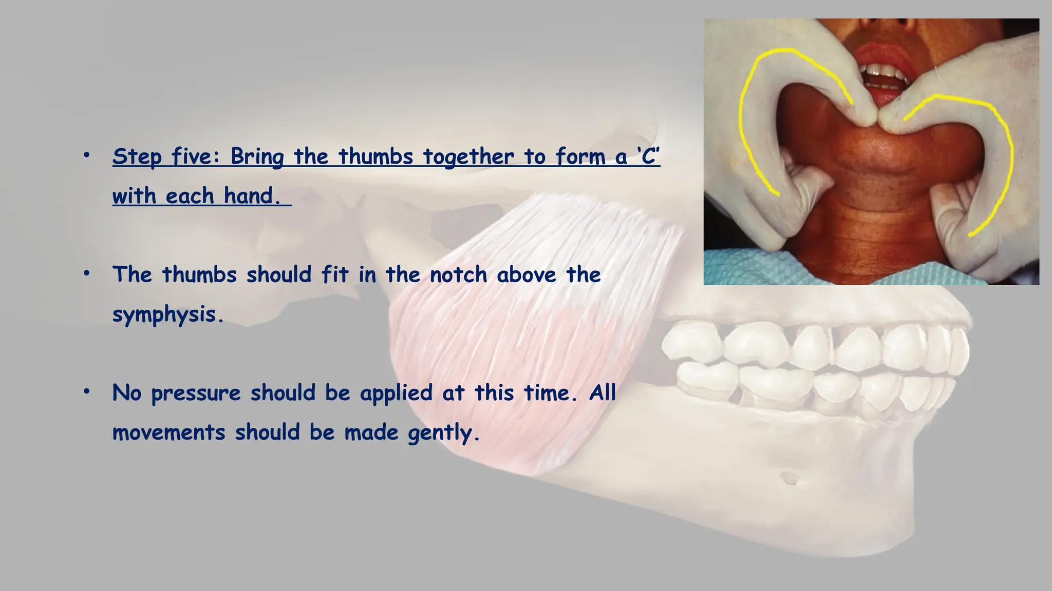 MAXILLO-MANDIBULAR RELATIONS IN PROSTHODONTICS | PPTX