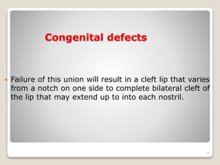 Congenital defects 
 Failure of this union will result in a cleft lip that varies 
from a notch on one side to complete bilateral cleft of 
the lip that may extend up to into each nostril. 
15 
 