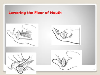 Lowering the Floor of Mouth 
54 
 