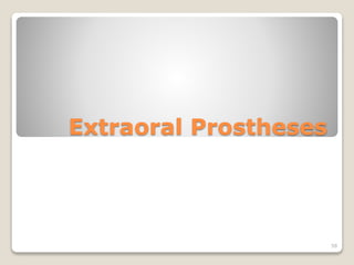 Extraoral Prostheses 
58 
 