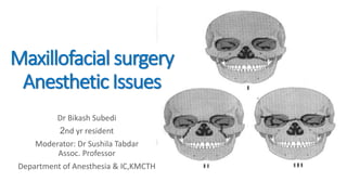 Maxillofacial surgery
Anesthetic Issues
Dr Bikash Subedi
2nd yr resident
Moderator: Dr Sushila Tabdar
Assoc. Professor
Department of Anesthesia & IC,KMCTH
 