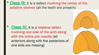Maxillary Defects Classification Maxillofacial defects (1).pptx slides and study | PPTX