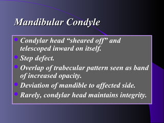 Mandibular Condyle
 Condylar  head “sheared off” and
  telescoped inward on itself.
 Step defect.
 Overlap of trabecular pattern seen as band
  of increased opacity.
 Deviation of mandible to affected side.
 Rarely, condylar head maintains integrity.
 