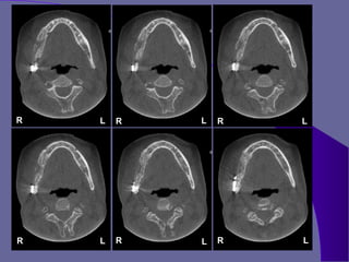 R   L   R   L   R   L




R   L   R   L   R   L
 