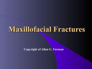 Maxillofacial Fractures

    Copyright of Allan G. Farman
 
