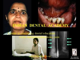 INDIAN DENTAL ACADEMY
Leader in continuing dental education
www.indiandentalacademy.com

www.indiandentalacademy.com

GK / MAXFAC
SDM DHARWAD

 