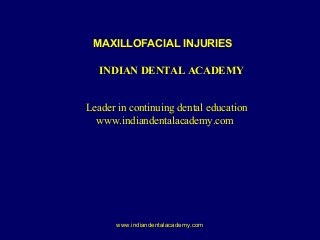 MAXILLOFACIAL INJURIES
INDIAN DENTAL ACADEMY
Leader in continuing dental education
www.indiandentalacademy.com

www.indiandentalacademy.com

 