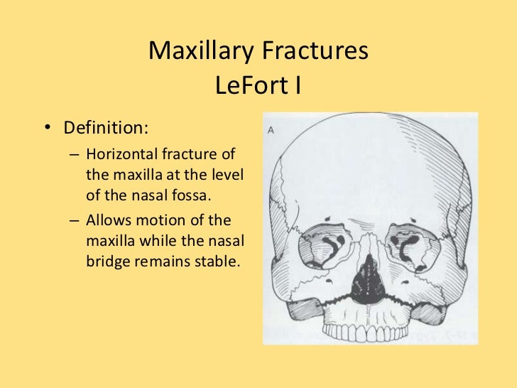 Maxillofacial injuries