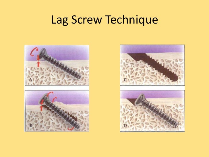 Maxillofacial injuries