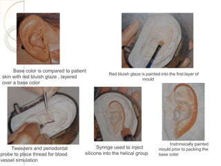 Base color is compared to patient 
skin with red bluish glaze , layered 
over a base color 
Red bluish glaze is painted into the first layer of 
mould 
Tweezers and periodontal 
probe to place thread for blood 
vessel simulation 
Syringe used to inject 
silicone into the helical group 
Instrinsically painted 
mould prior to packing the 
base color 
 