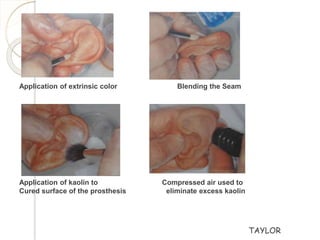  
Application of extrinsic color Blending the Seam 
Application of kaolin to Compressed air used to 
Cured surface of the prosthesis eliminate excess kaolin 
TAYLOR 
 