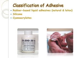 Classification of Adhesive 
 Rubber-based liquid adhesives (natural & latex) 
 Silicone 
 Cyanoacrylates 
 