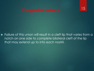 Congenital defects 
15 
 Failure of this union will result in a cleft lip that varies from a 
notch on one side to complete bilateral cleft of the lip 
that may extend up to into each nostril. 
 