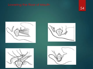 Lowering the Floor of Mouth 
54 
 