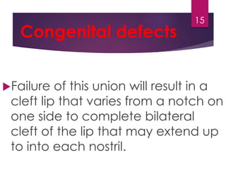Congenital defects 
15 
Failure of this union will result in a 
cleft lip that varies from a notch on 
one side to complete bilateral 
cleft of the lip that may extend up 
to into each nostril. 
 