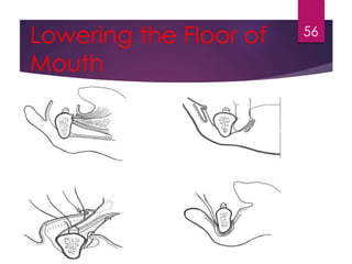 Lowering the Floor of 
Mouth 
56 
 