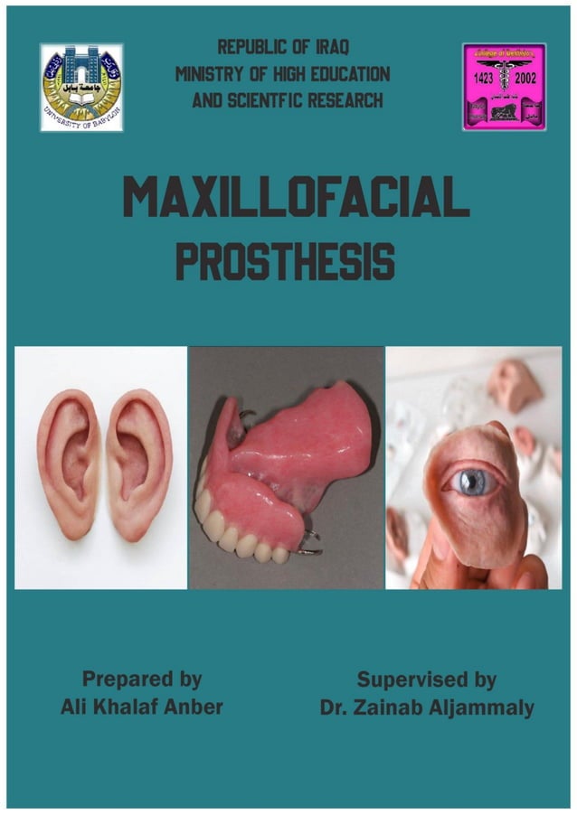 Maxillofacial Prosthesis PDF
