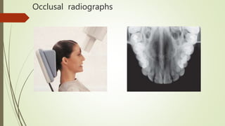 Maxillofacial radiology | PPTX