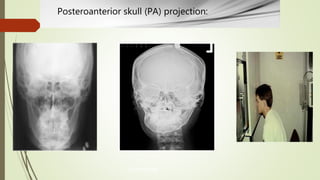 Maxillofacial radiology | PPTX