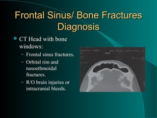 Frontal Sinus/ Bone Fractures
          Diagnosis
 CTHead with bone
 windows:
  – Frontal sinus fractures.
  – Orbital rim and
    nasoethmoidal
    fractures.
  – R/O brain injuries or
    intracranial bleeds.
 