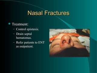 Nasal Fractures
 Treatment:
  – Control epistaxis.
  – Drain septal
    hematomas.
  – Refer patients to ENT
    as outpatient.
 