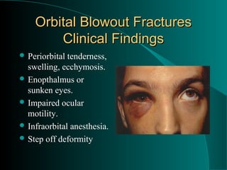Orbital Blowout Fractures
        Clinical Findings
 Periorbital tenderness,
  swelling, ecchymosis.
 Enopthalmus or
  sunken eyes.
 Impaired ocular
  motility.
 Infraorbital anesthesia.
 Step off deformity
 