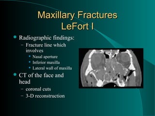 Maxillary Fractures
                   LeFort I
 Radiographic        findings:
  – Fracture line which
    involves
          Nasal aperture
          Inferior maxilla
          Lateral wall of maxilla
 CT of the face and
  head
  – coronal cuts
  – 3-D reconstruction
 